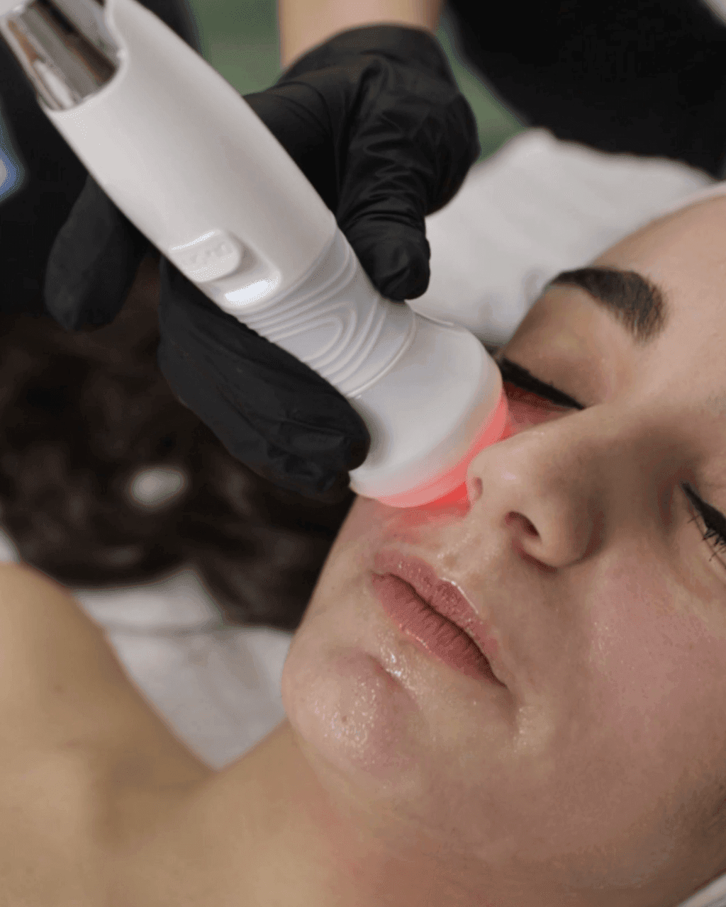 Manipolo Ultrasuoni di Hidraskin durante un trattamento viso