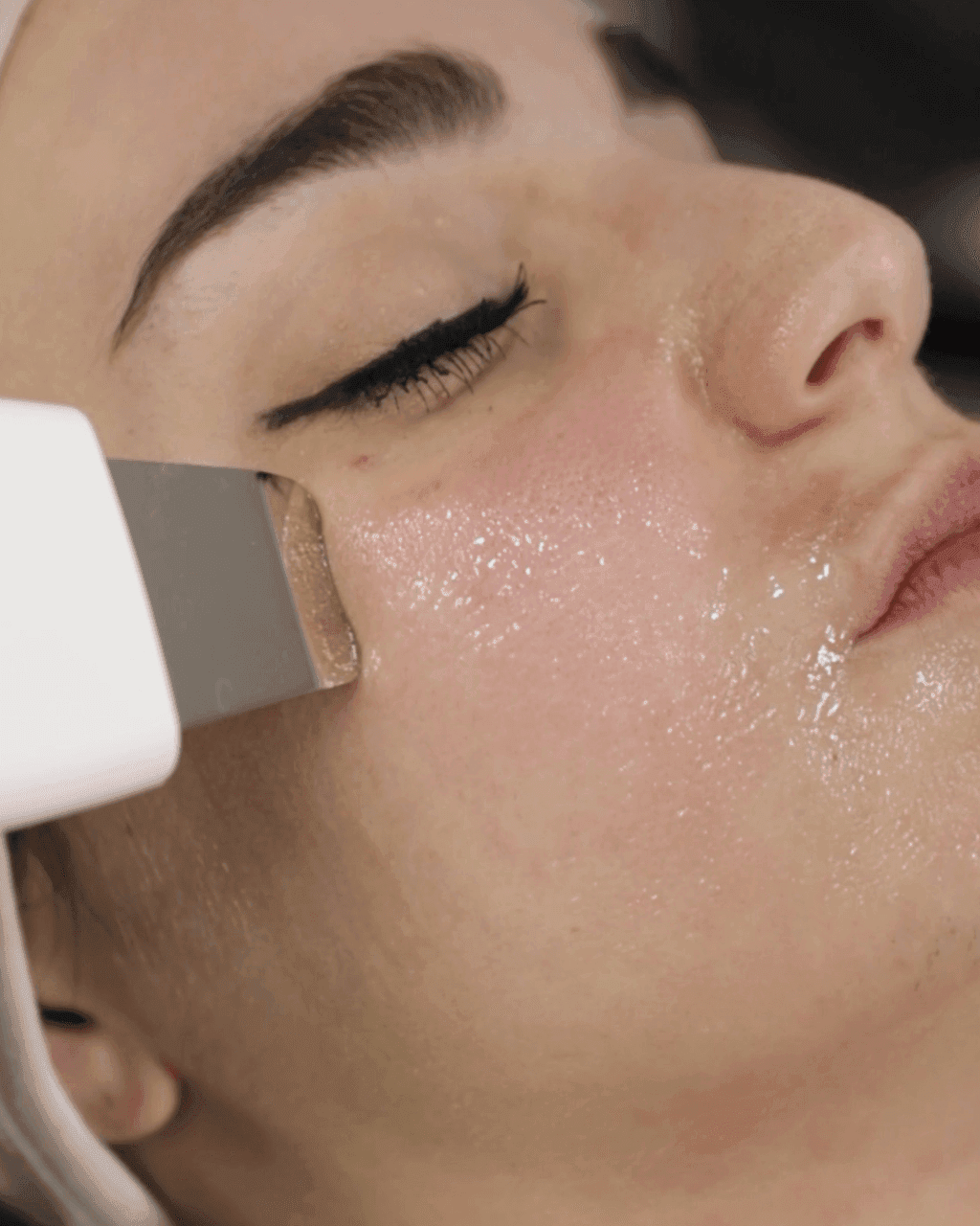 Spatola Ultrasuoni di Hidraskin durante un trattamento viso